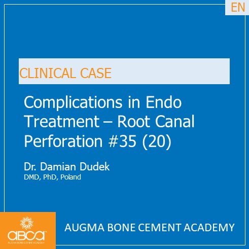 Complications in Endo Treatment – Root Canal Perforation #35 (20)