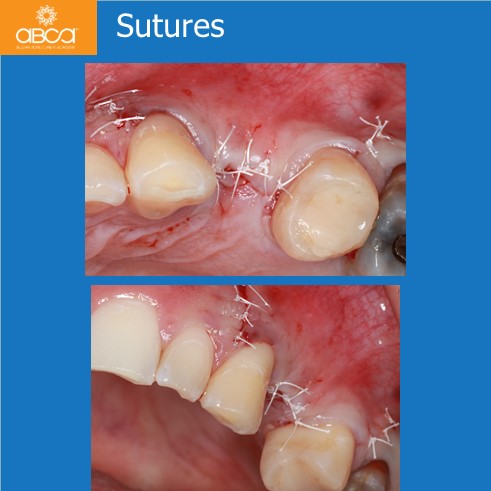 Clinical Case