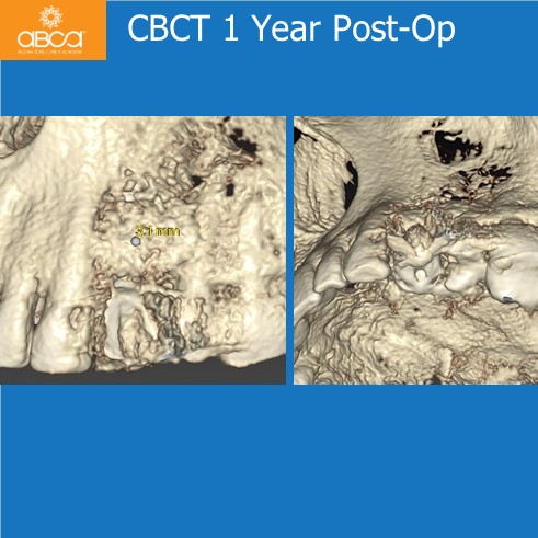 Clinical Case