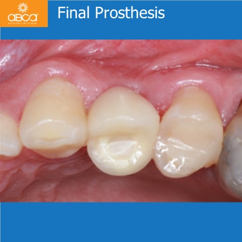 Clinical Case