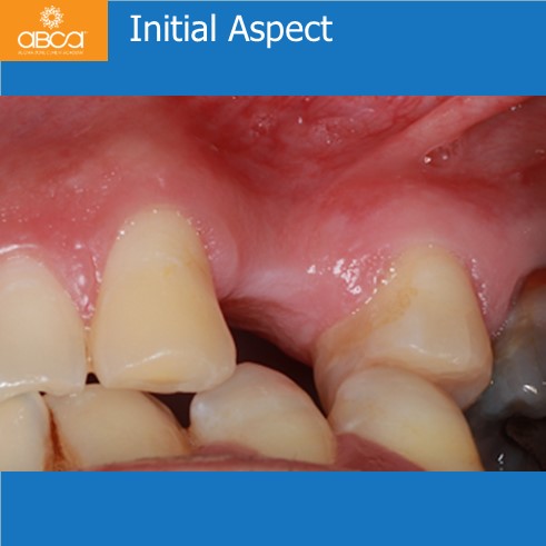 Clinical Case