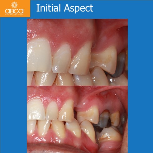 Clinical Case