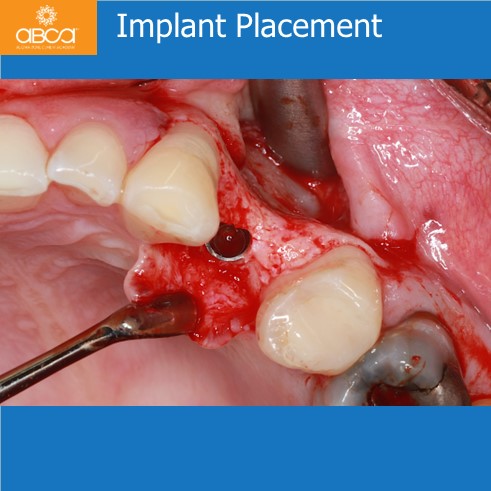 Clinical Case