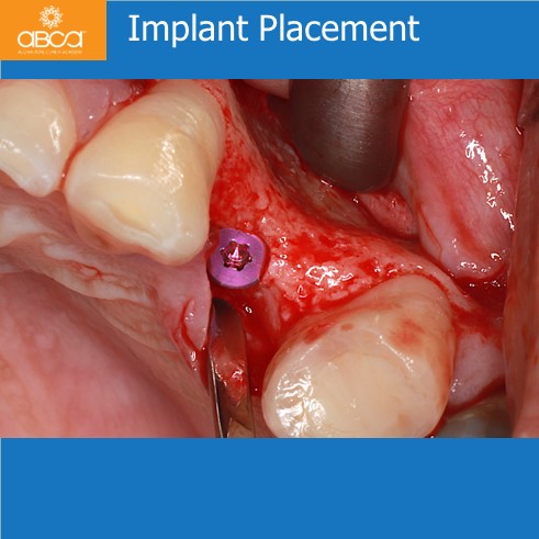 Clinical Case